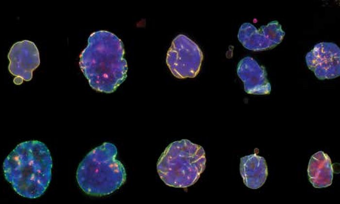 Verformte Zellkerne von HGPS Zellen