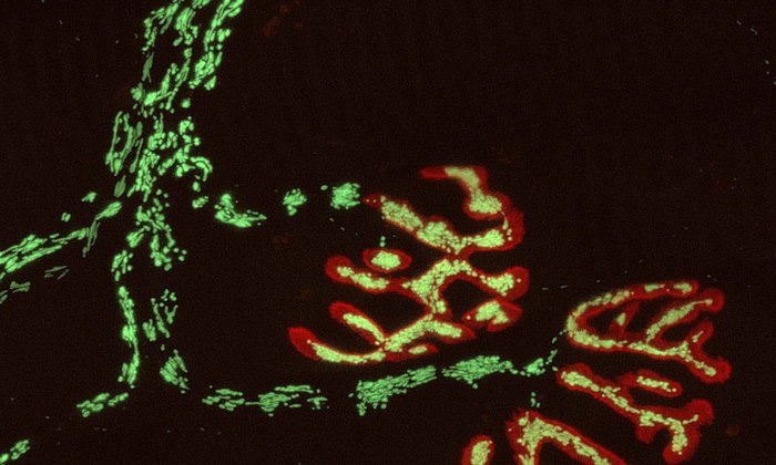 The micrograph shows a peripheral nerve, with the neuromuscular endplates stained in red. The nerve-cell mitochondria were imaged with a fluorescent redox sensor (green in the cytoplasm, yellow at the endplates). (Picture: M. Kerschensteiner and T. Misgeld)