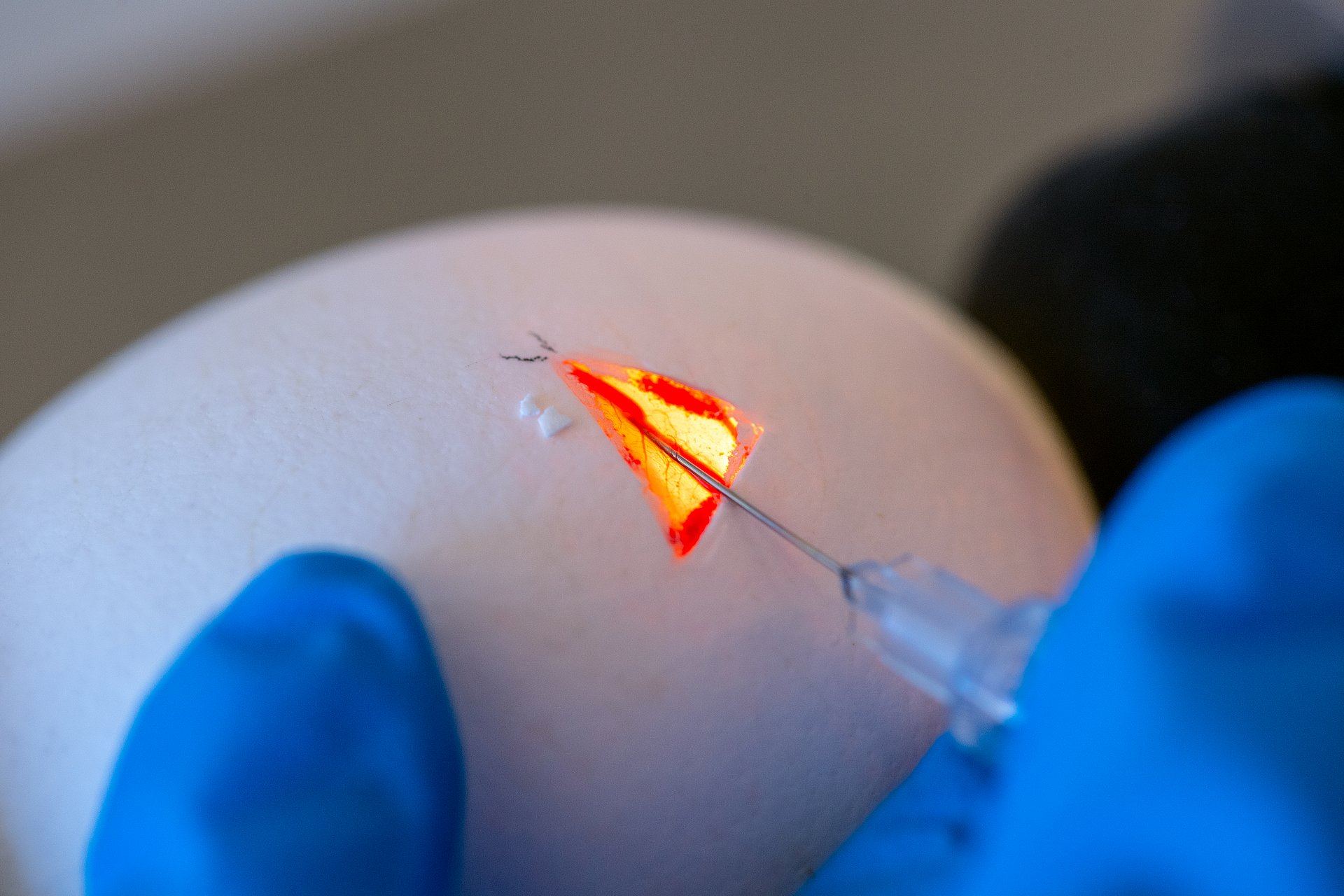 Scientists at TUM have created chickens and pigs with integrated genetic scissors. This can be used at all stages of the animals' development. They have already demonstrated applications in chicken embryos (image) as well as in living pigs.
