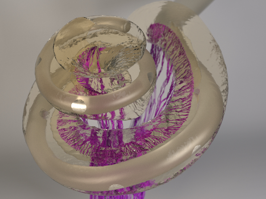 3-D-Abbildung des menschlichen Innenohrs mit einer Cochlea-Implantatelektrode erstellt auf Grundlage hochaufgelöster Computertomografie. In violett sind die rekonstruierten Fasern des Hörnerven dargestellt, die von der Hörschnecke durch den Knochen hindurch Richtung Gehirn verlaufen. 