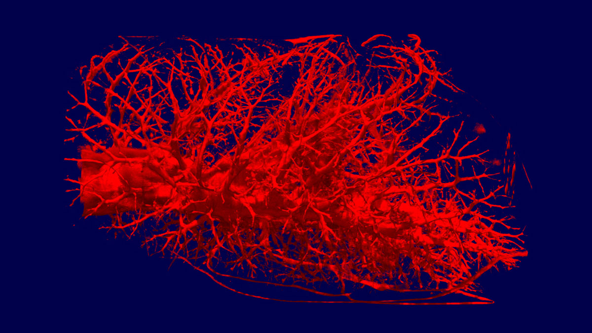 3D-Tomografie einer Säugetierlunge. (Bild: Robert Metzke, Burkhard Schillinger, TU München)