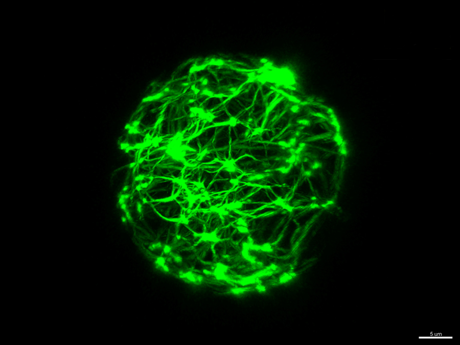 Reconstitution of active cytoskeletal vesicles. The active cytoskeleton (green)exerts forces to the surrounding lipid membrane – Image: Etienne Loiseau / TUM