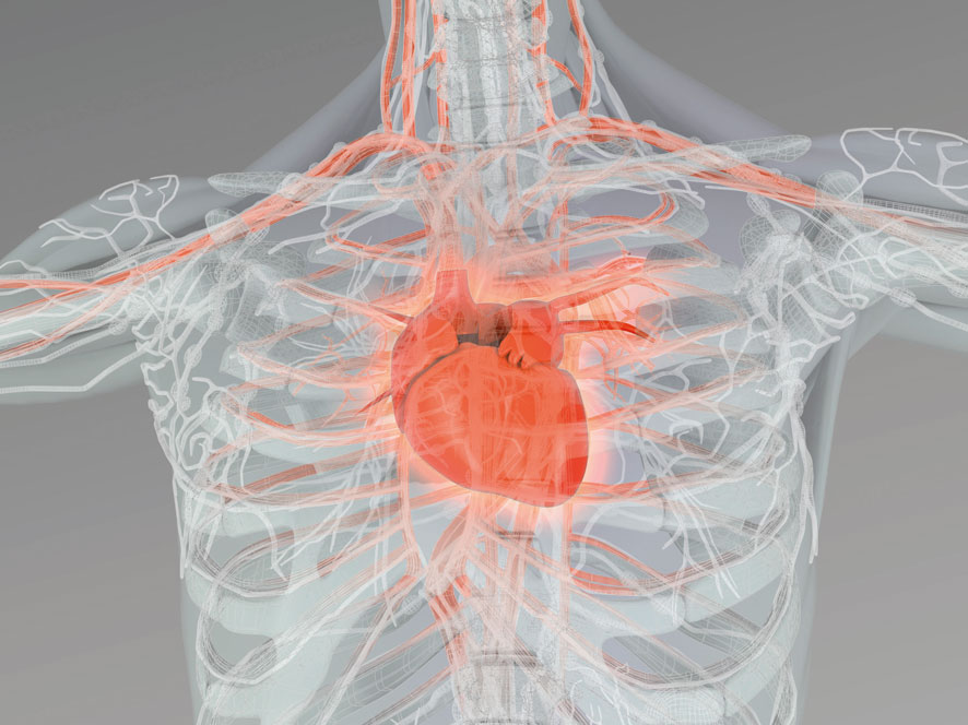 Der Herzinfarkt zählt weltweit zu den häufigsten Todesursachen: Forscher entdeckten Genveränderungen, die das Risiko einer Erkrankung dramatisch erhöhen