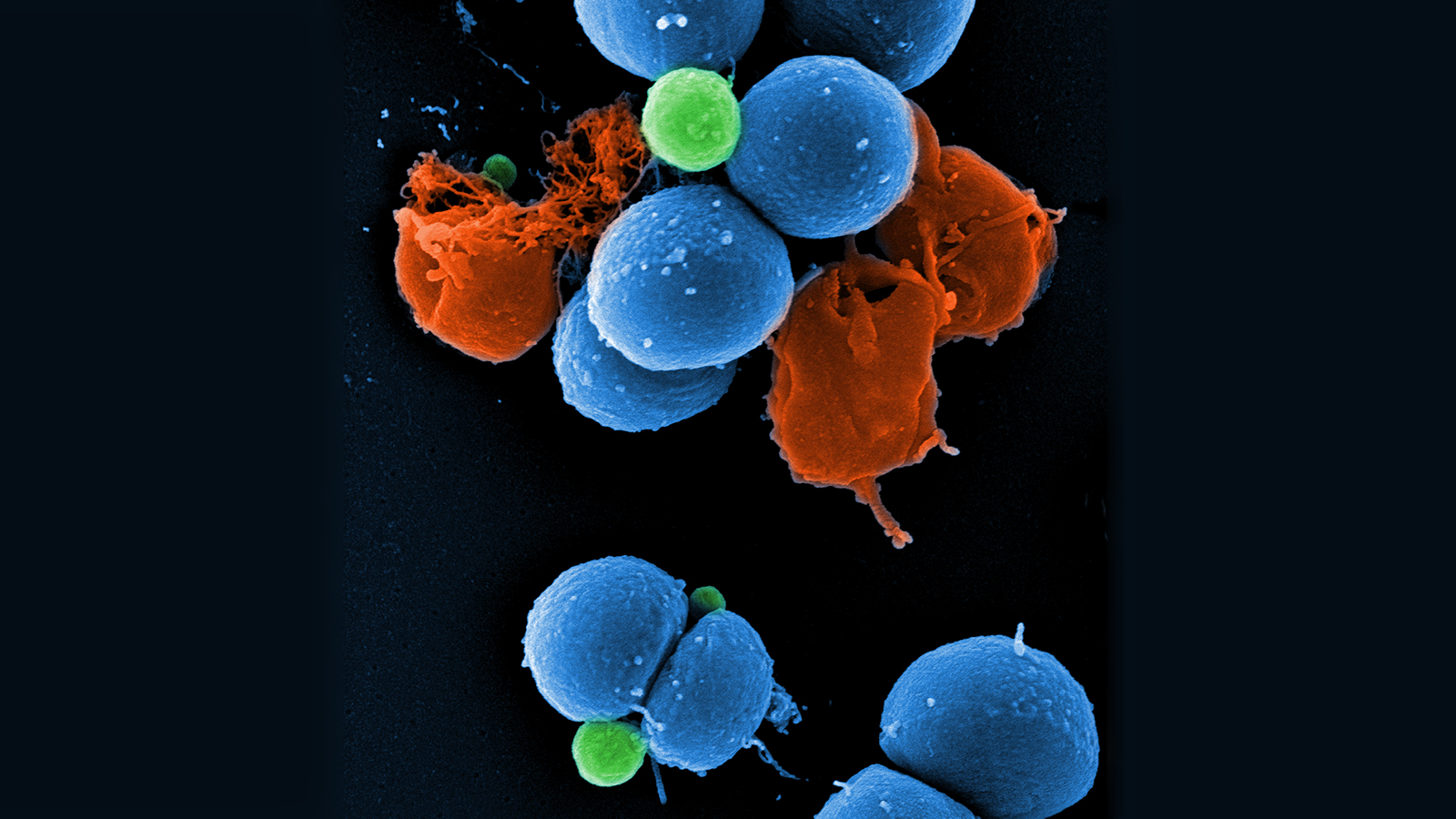 Rasterelektronenmikroskopische Aufnahme von intakten MRSA (blau), durch die Wirkung von PK150 induzierte Vesikelbildung (grün) und durch PK150 zerstörte MRSA (rot).