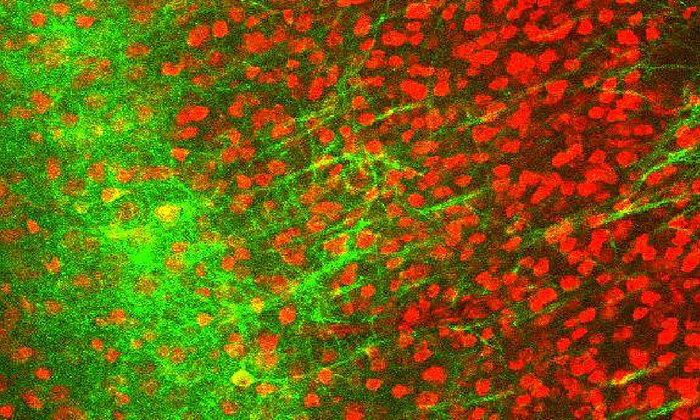 Wie entstehen die langsame Gehirnwellen im Schlaf? Für ihre Versuche haben die Wissenschaftler lichtsensitive Moleküle in spezifische Neuronen (grün im Bild) eingebracht, die auf Licht reagieren.