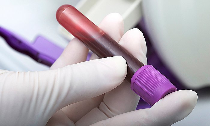 Für den neuen Bluttest werden Blutproben der Patienten entnommen und auf zwei Proteinmarker untersucht. (Bild: Gab13 / istockphotos)