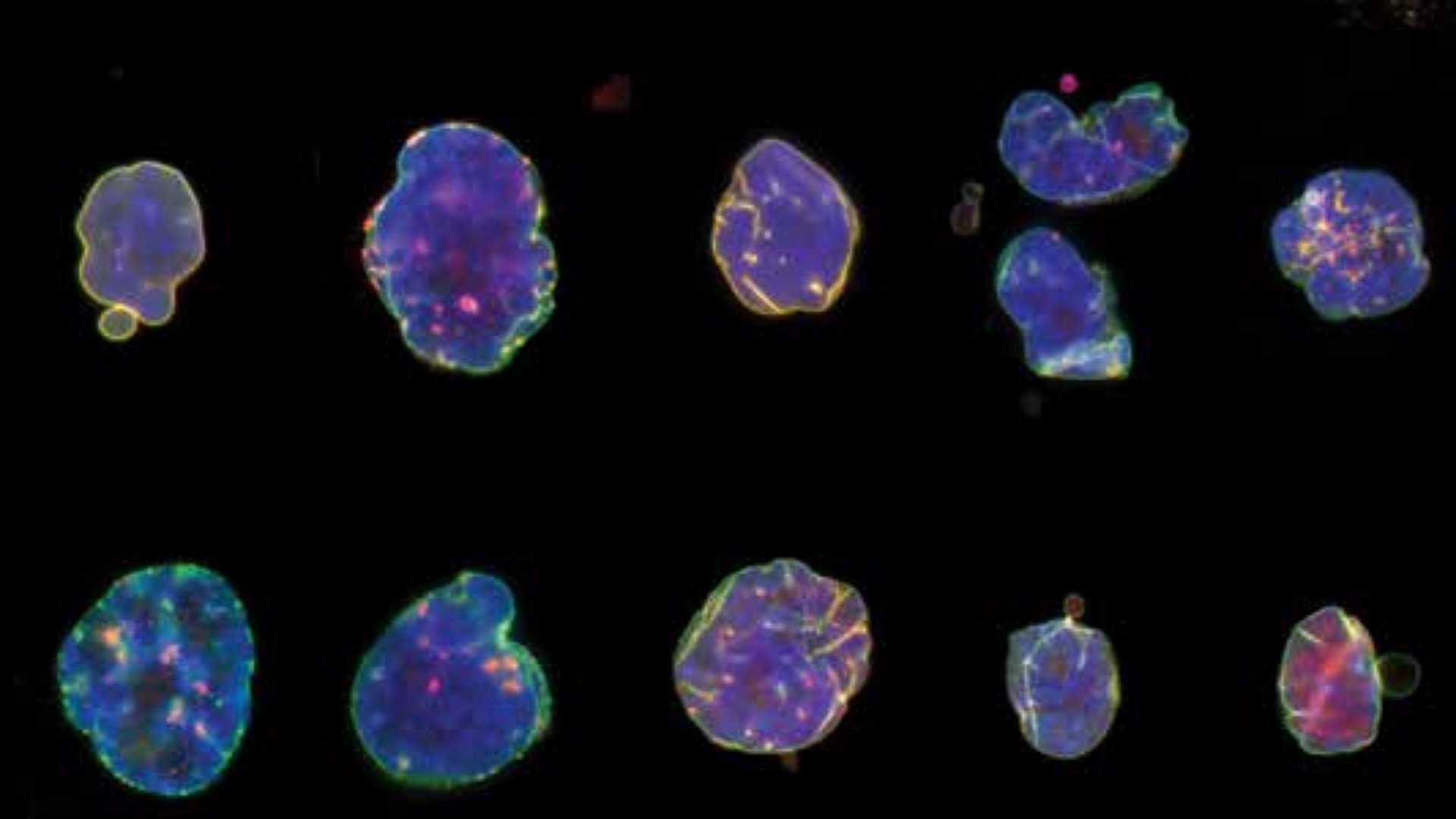 Nuclei of HGPS cells.