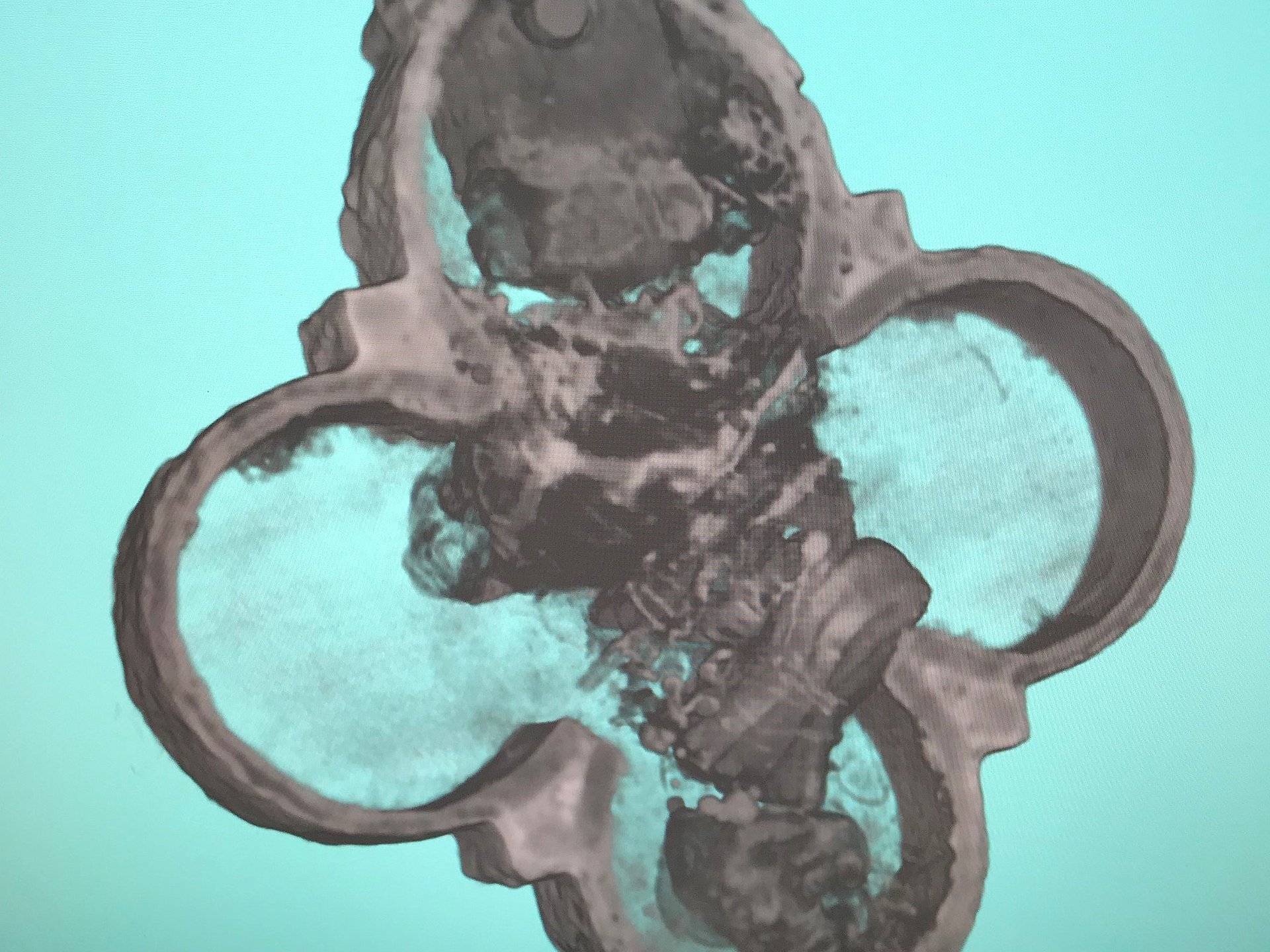 Neutron tomography shows the interior of the relic pendant.