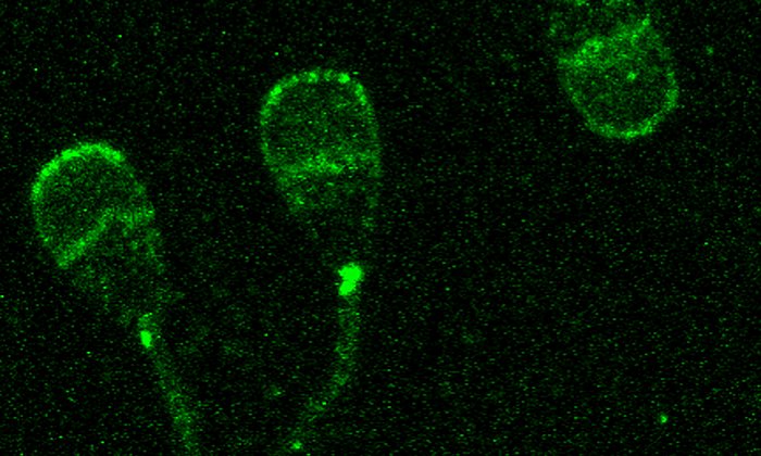 Jetzt identifiziert: Das Protein TMEM95 (grüne Färbung) auf den Spermienköpfen von Rinderbullen. Fehlt es, sind die Tiere unfruchtbar.