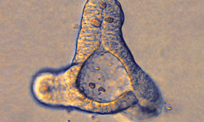 Organoids just a quarter of a millimeter across exhibit functions of the human intestine. (Photo: TUM/ Zietek)