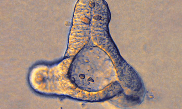 Viertelmillimeter große Organoide haben essentielle Funktionen eines echten Darms. (Foto: TUM/ Zietek)