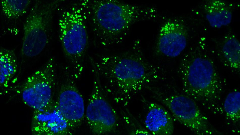 Fluoreszenzmikroskopie-Bild, das die intrazelluläre Verteilung von supramolekularen Käfigkomplexen in Melanosomen in menschlichen Krebszellen zeigt (Zellkerne sind mit blauer Fluoreszenz dargestellt). Die Käfige umschließen Medikamente, die in grün angefärbt sind. 