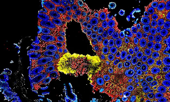 Intestinal tissue during a graft-versus-host reaction