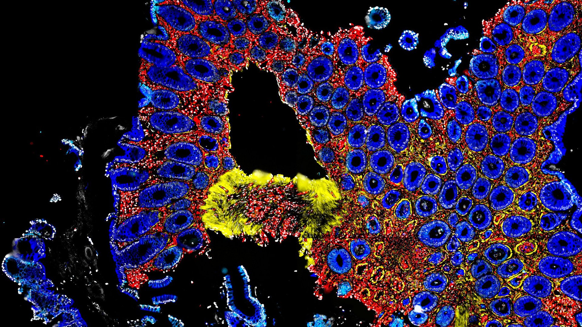 Intestinal tissue during a graft-versus-host reaction