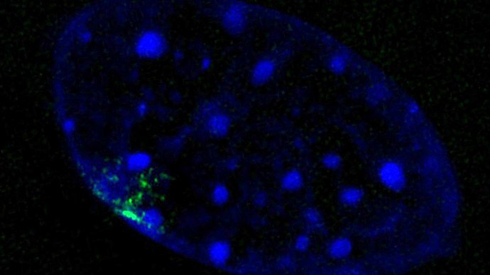 a cell nucleus in which the Barr body is marked in green a cell nucleus in which the Barr body is marked in green