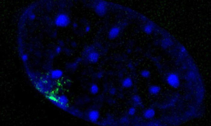 a cell nucleus in which the Barr body is marked in green