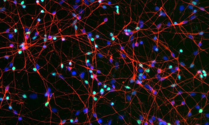 Laboratory-grown brain cells from human stem cells