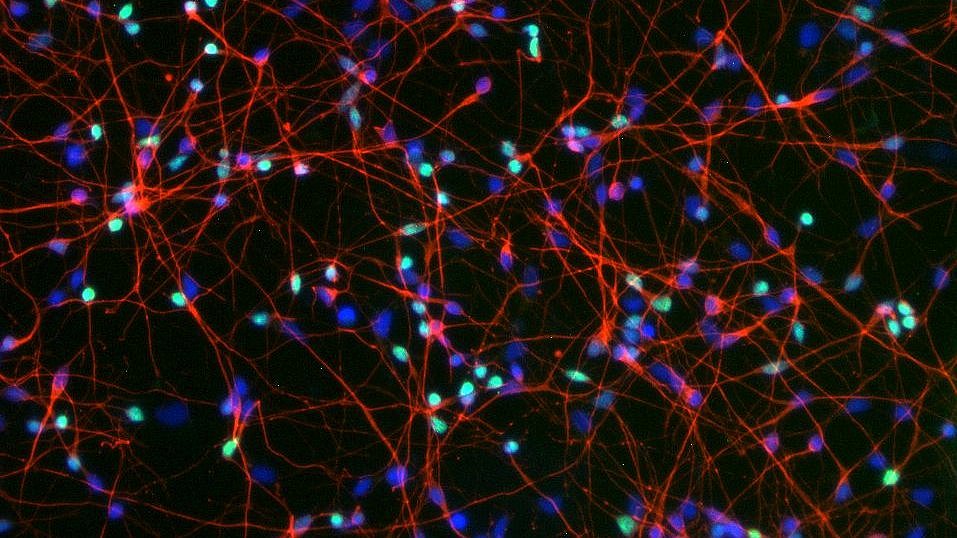 Im Labor gezüchtete Gehirnzellen aus humanen Stammzellen