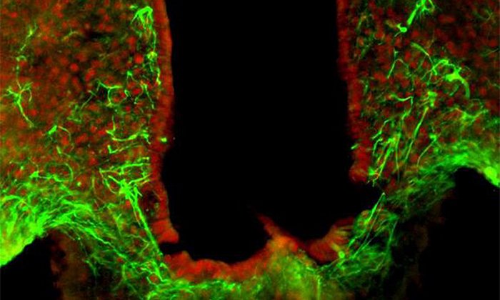 HDAC5 (rot) spielt in Nervenzellen eine wichtige Rolle für die Kontrolle der Nahrungsaufnahme, umliegende Astrozyten sind in grün eingefärbt.