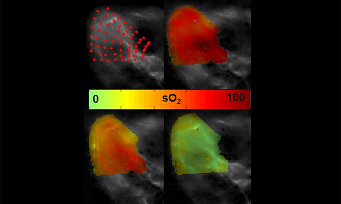 An eMSOT image in which high and low levels of oxygen are shown in red and green (image: Tzoumas / TUM)