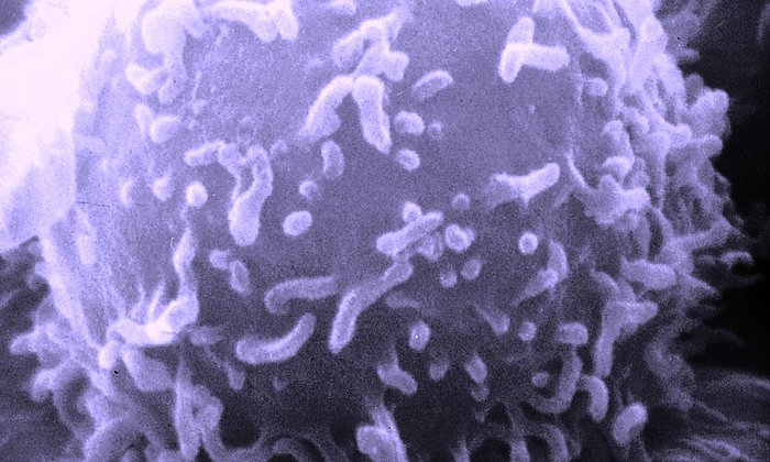 Mikroskopaufnahme einer Immunzelle (Foto / Dr. Triche, National Cancer Institute)