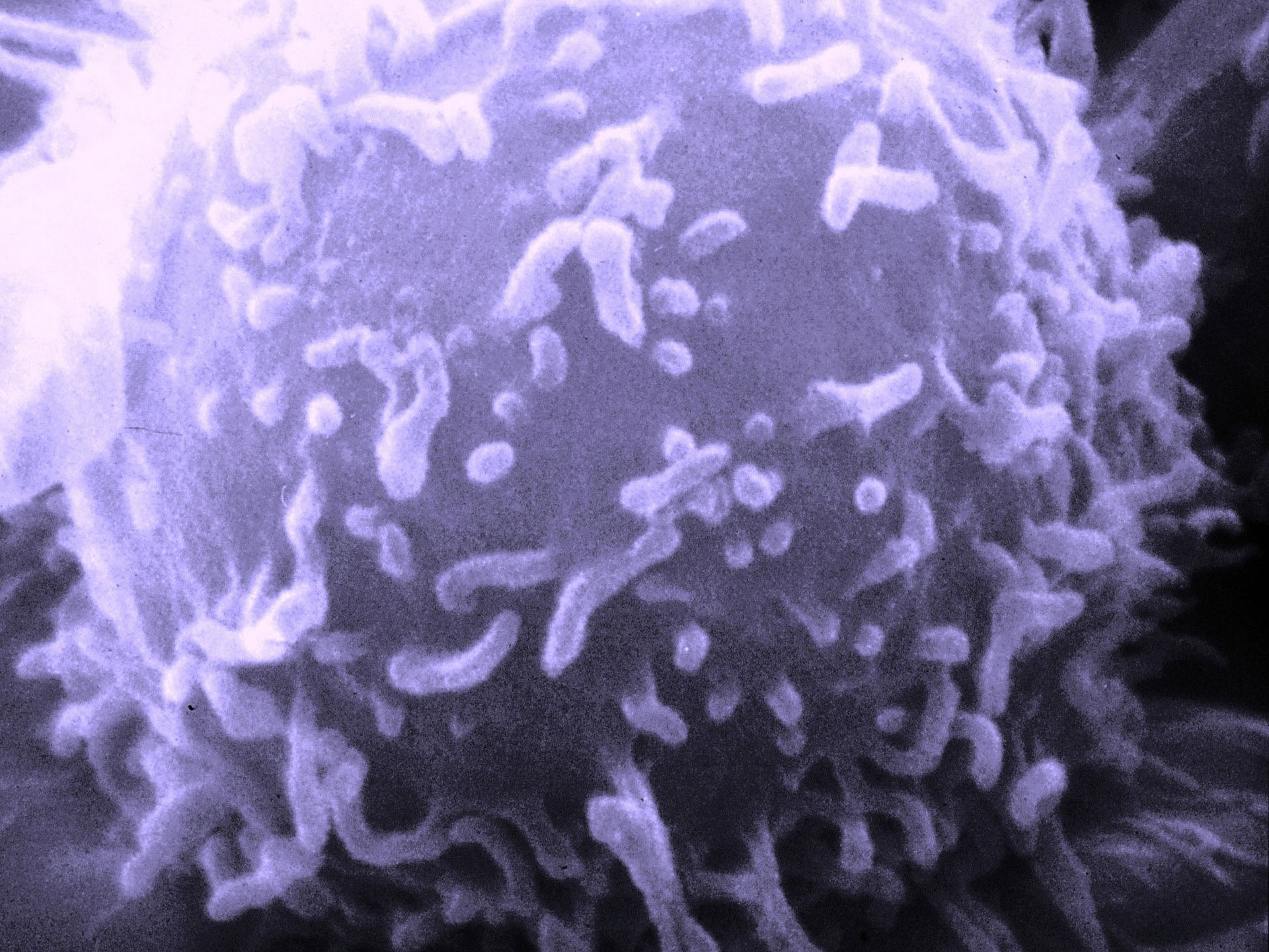 Mikroskopaufnahme einer Immunzelle (Foto / Dr. Triche, National Cancer Institute)