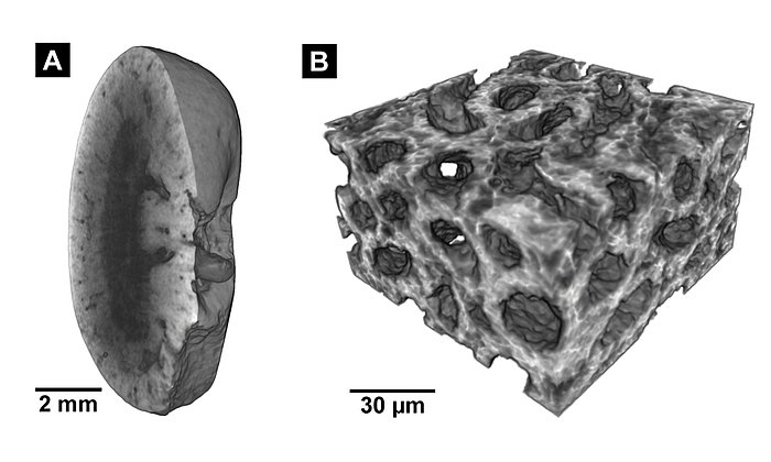 Links: Micro-CT-Aufnahme einer Mausniere, rechts: Nano-CT-Aufnahme des Gewebes.