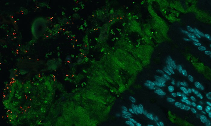 Im Fokus von Ernährungswissenschaftlern an der TUM: Das Mikrobiom des Darms. Rot dargestellt sind die Bakterien, grün die Schleimschicht und blau die Epithelzellen im Darm.