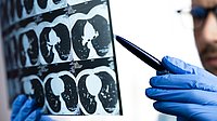 A doctor examining a CT scan