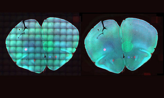 Mit der Software BaSiC verbessertes Mosaikbild eines Maushirn-Schnitts. (Bild: Tingying Peng / TUM/HMGU)