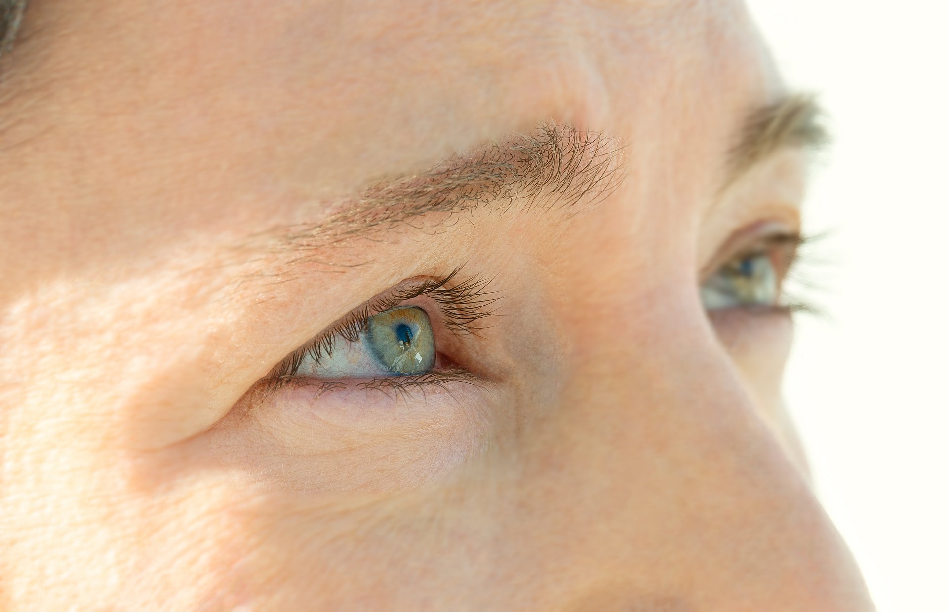 Menschliches Auge, grauer Star In cataracts, the lens of the eye, which is actually clear, becomes cloudy.