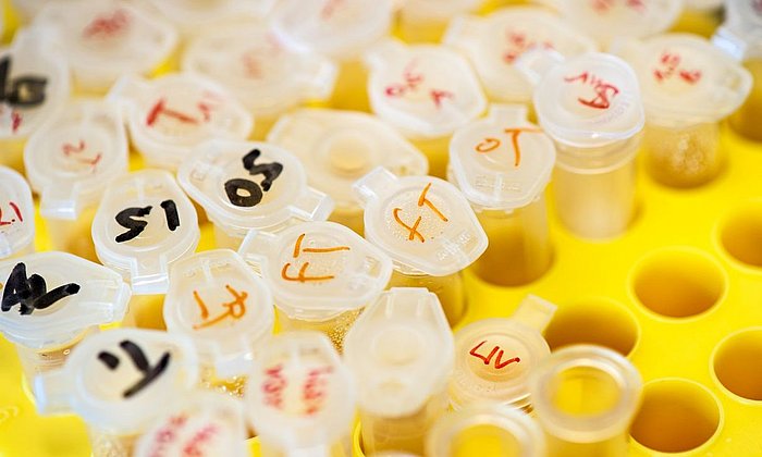 Reaction tubes labeled for an experiment stand in a rack in the laboratory of Prof. Jürgen Ruland's working group.