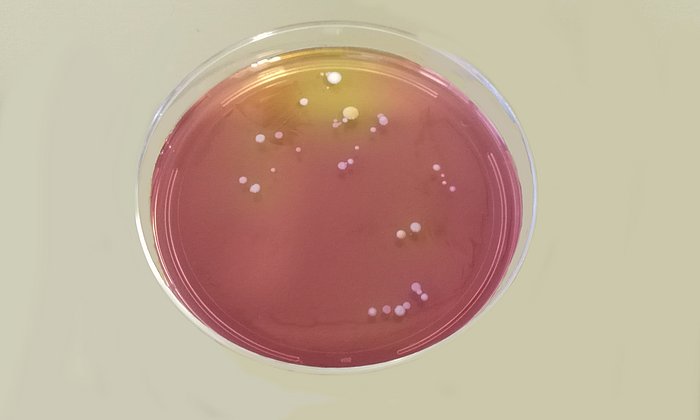 Kolonien des Bakteriums Staphyloccocus aureus auf einer Agarplatte. (Bild: M. Reiger / Helmholtz Zentrum München)