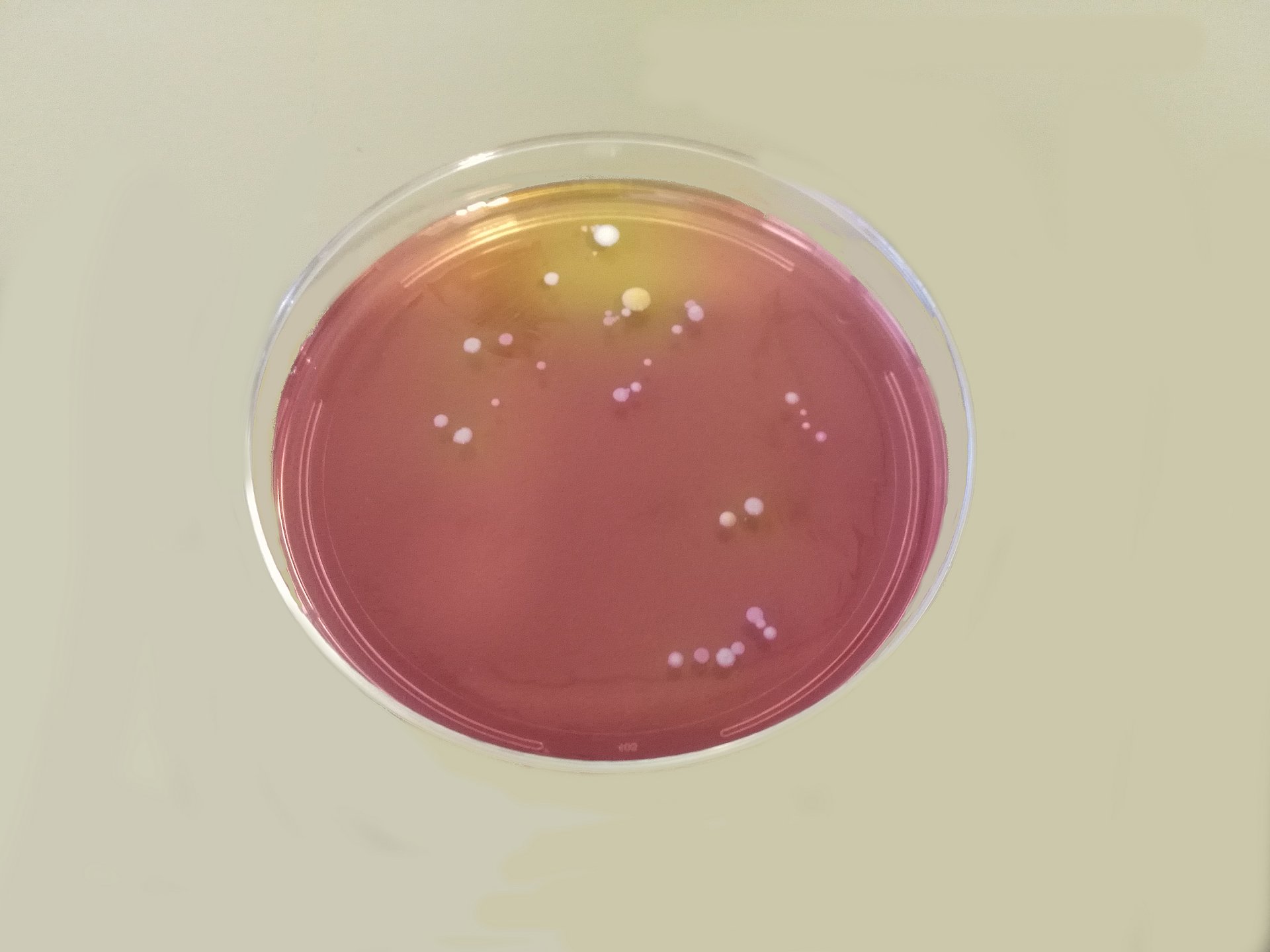 Kolonien des Bakteriums Staphyloccocus aureus auf einer Agarplatte. (Bild: M. Reiger / Helmholtz Zentrum München)