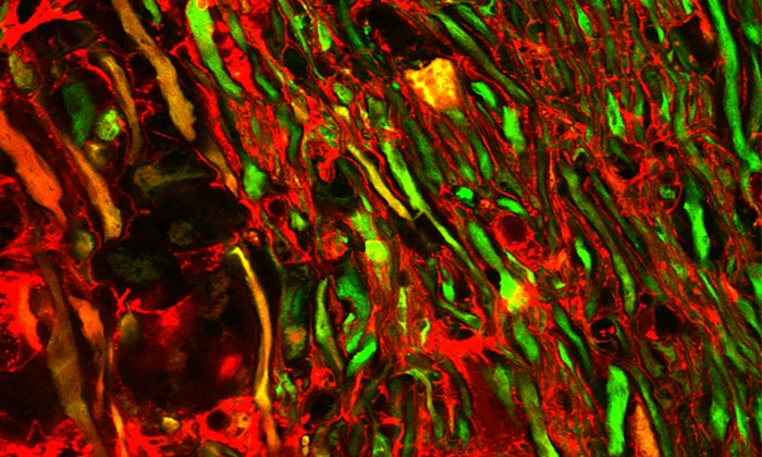 Microscopic image of the spinal cord: Damaged nerve fibers absorb a red fluorescent dye, axons without dye absorption appear green. (Image: M. Witte / LMU)