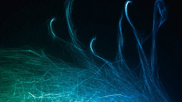 Microscopy image show the movements of filaments in a cell’s scaffolding