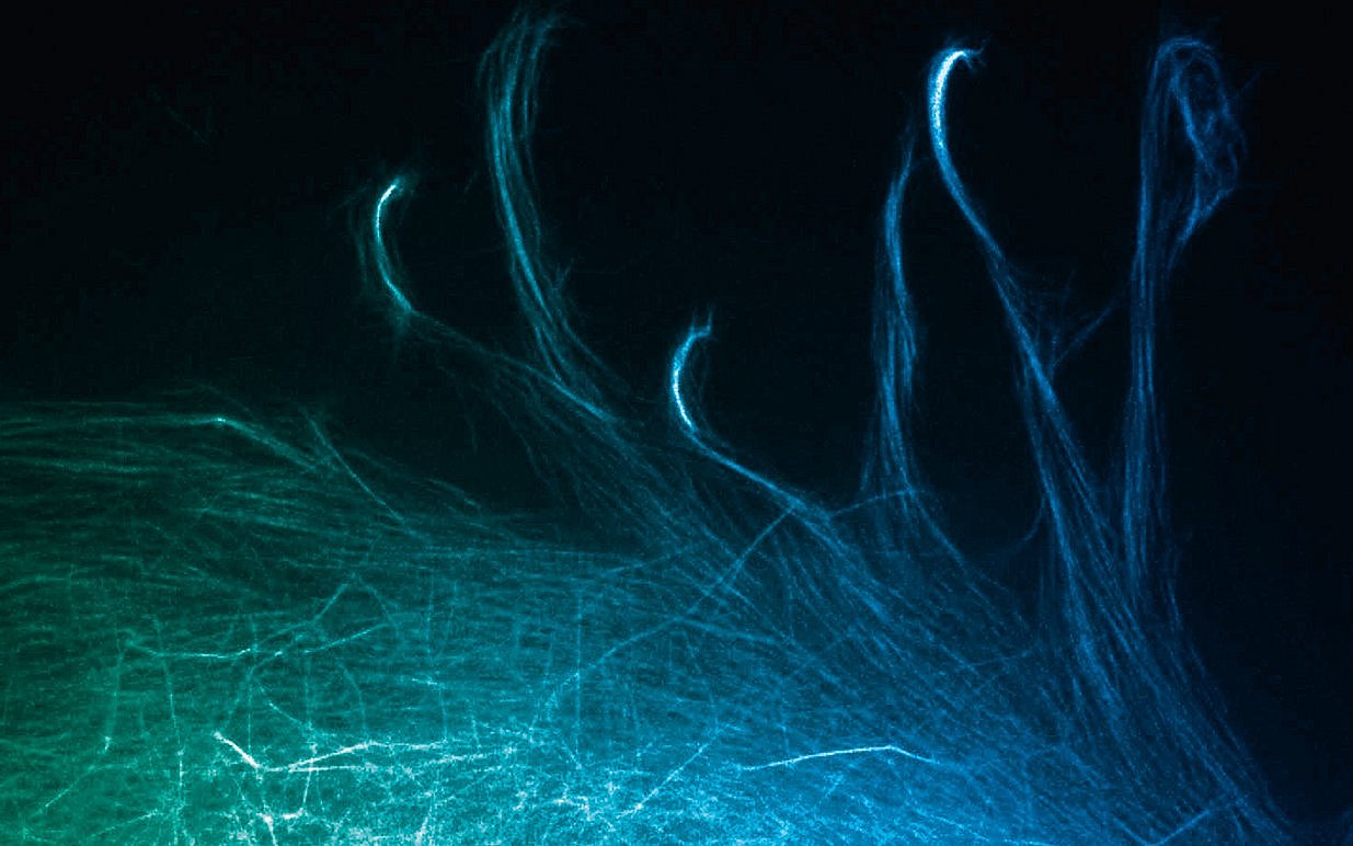 Microscopy image show the movements of filaments in a cell’s scaffolding