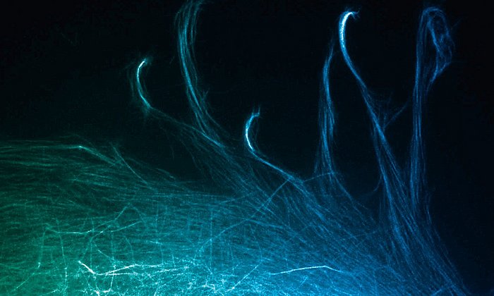 Microscopy image show the movements of filaments in a cell’s scaffolding