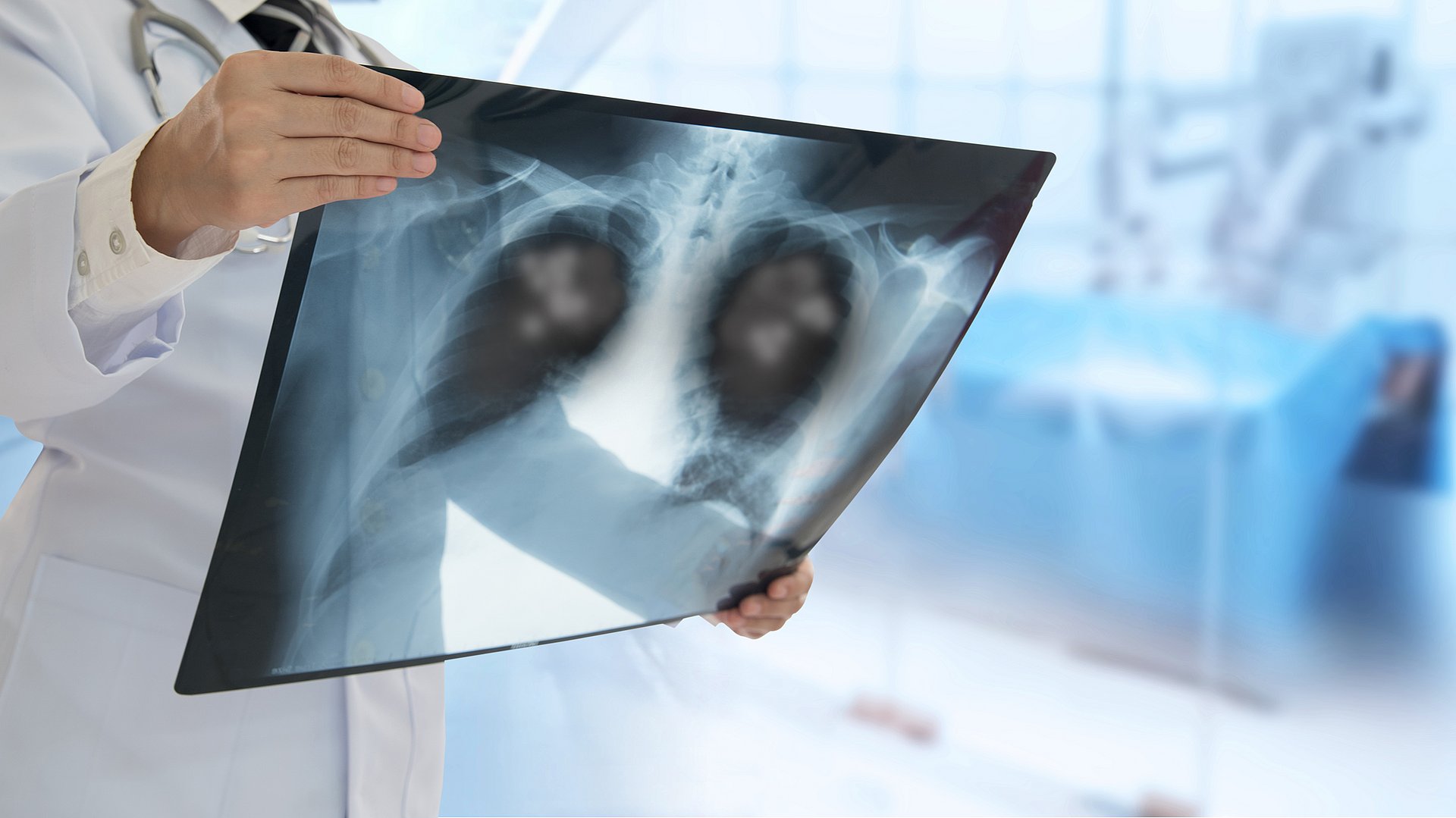 Röntgen-Aufnahme einer Lunge