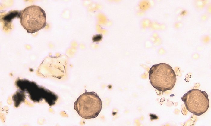 Birch pollen (close-up)