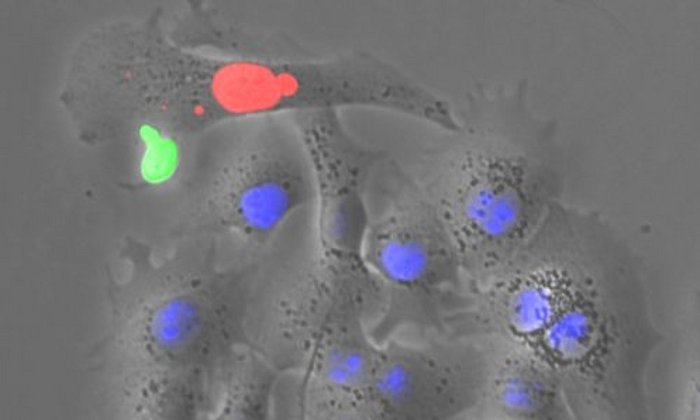 Das Bild zeigt eine HBV-spezifische T Zelle (grün), die eine Zielzelle angreift, in der Virusproteine gebildet werden (rot) und HBV negative Zellen (blau). 