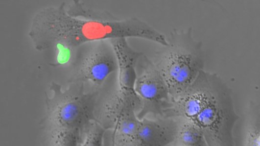 Das Bild zeigt eine HBV-spezifische T Zelle (grün), die eine Zielzelle angreift, in der Virusproteine gebildet werden (rot) und HBV negative Zellen (blau). 