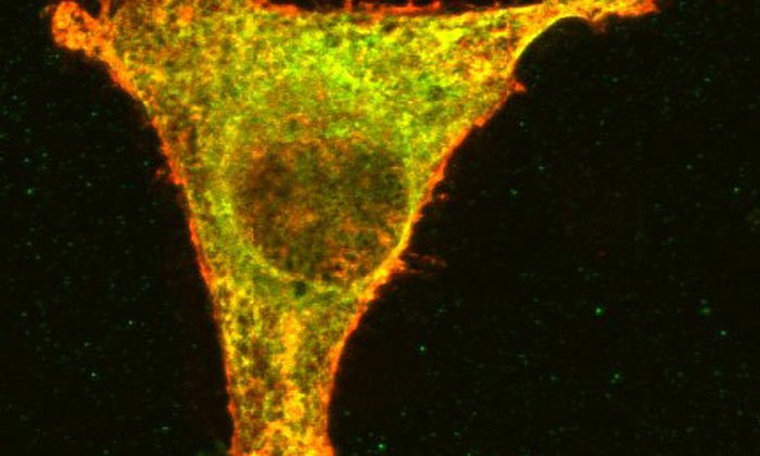 Tumorzelle mit hervorgehobenen Proteinen in der Zellwand (FOTO: Bassermann/TUM)