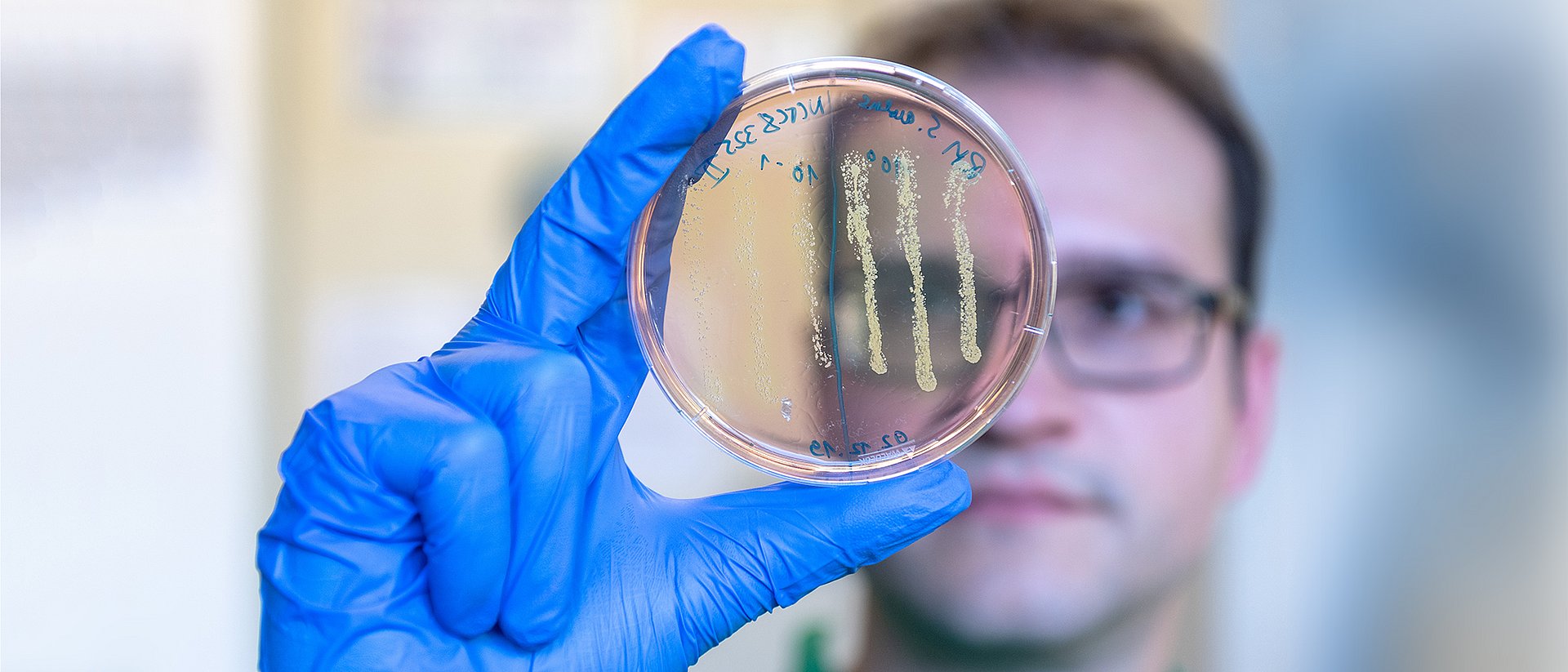 PhD-student Robert Macsics examining an agar plate on which colonies of the Staphylococcus aureus bacteria have grown. The color change of the plate from red to yellow in the area of the bacterial colonies indicates that they are bacteria of the species S. aureus.