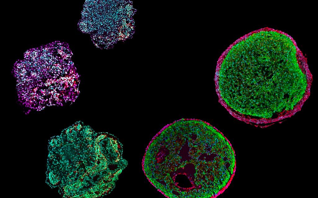 Developmental stages of cardiac organoids visualized in fluorescence imaging.