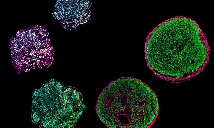 Developmental stages of cardiac organoids visualized in fluorescence imaging.
