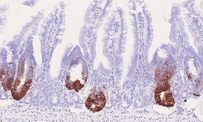 HSP60 in Mitochondrien kontrolliert die Stammzellproliferation im Darmepithel. HSP60-negative Krypten im Darm zeichnen sich durch den Verlust von braungefärbten Stammzellen aus, während HSP60-positive Darmareale eine verstärkte Stammzellproliferation zeigen. (Foto: Team Haller/ TUM)