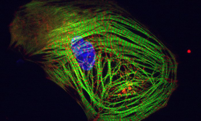 Im Labor gezüchtete Herzzellen werden mithilfe von Quallenproteinen zum Leuchten gebracht. (Foto: Alessandra Moretti /TUM)