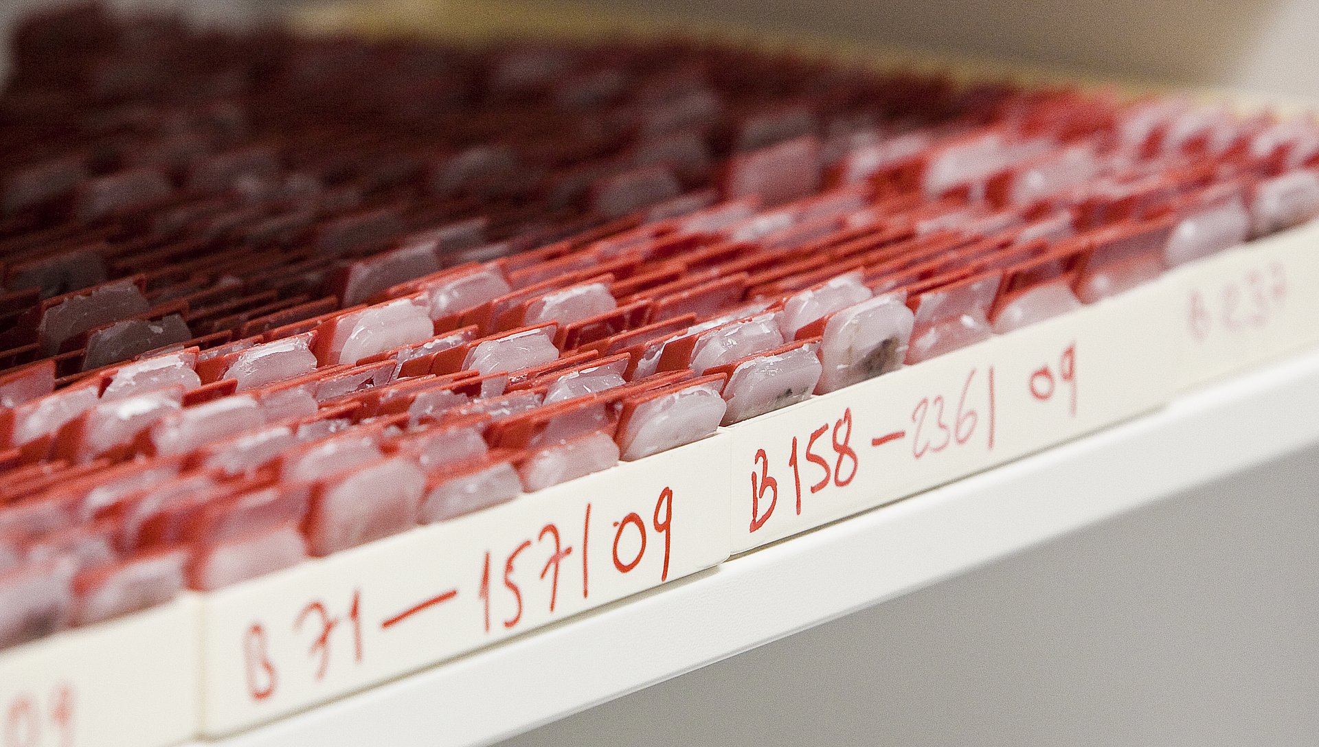 Clinical tissue samples - image: S. Willax/TU München
