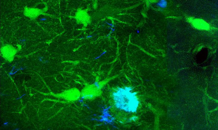 Zwei-Photonen-Mikroskopie: Aufnahme von Zellen (grün) und Amyloid-β Plaques (blau) im Alzheimer-Gehirn. (Bild: Marc Aurel Busche / TUM)